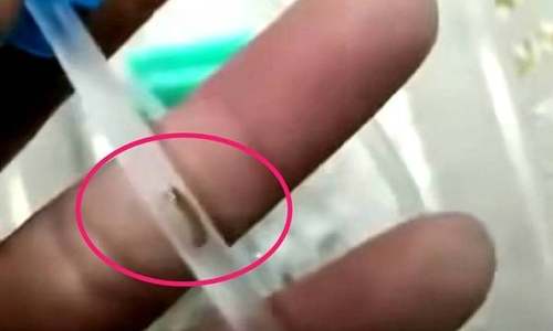 三岁幼童医院输液，却吓坏了旁边父亲