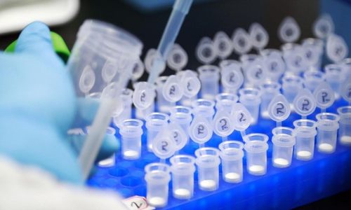 玛丽安热拉·西芒：世卫组织正评估中国国药集团新冠疫苗